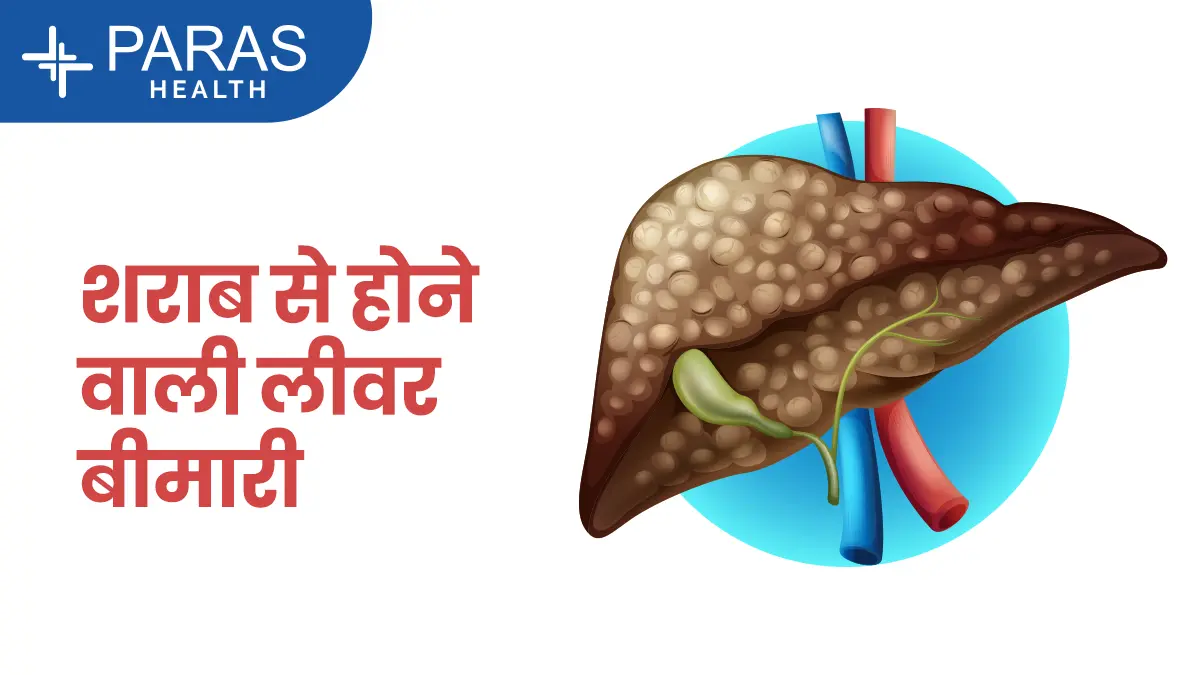 sharab ka liver par asar